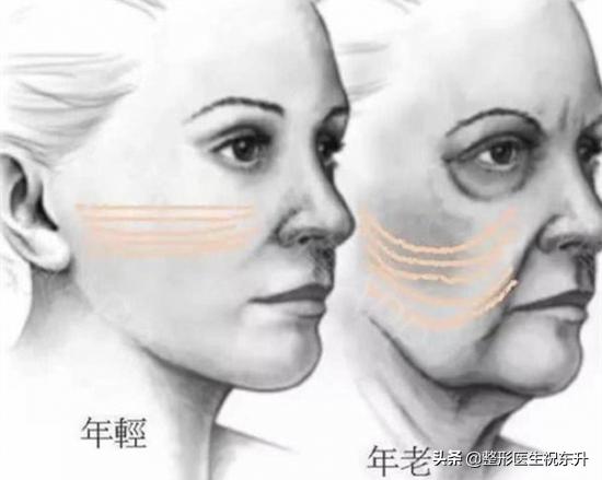 超声刀超做视频
:什么人适合做超声刀？  第4张