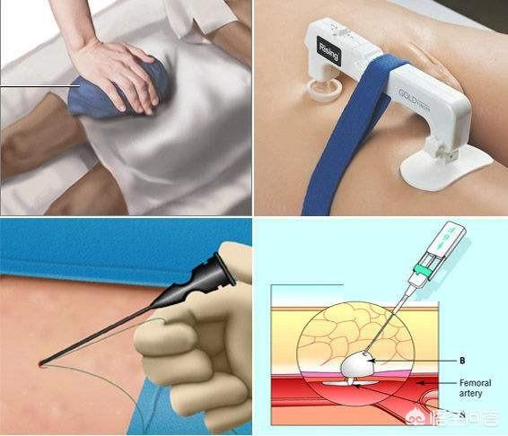 心脏造影怎么做视频
:心脏造影怎么做？  第5张