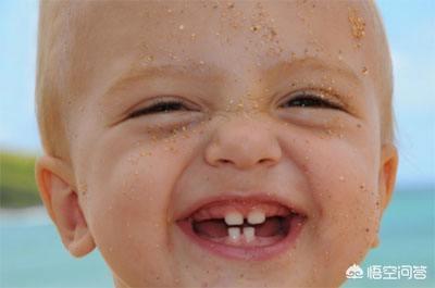 儿童保护牙齿宣传视频
:怎样保护儿童乳牙才是正确的选择？  第1张
