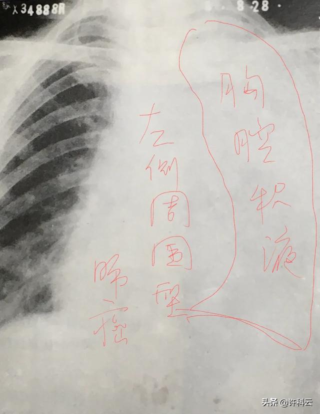放射科宣传视频
:学医的你，对放射科了解多少？  第1张