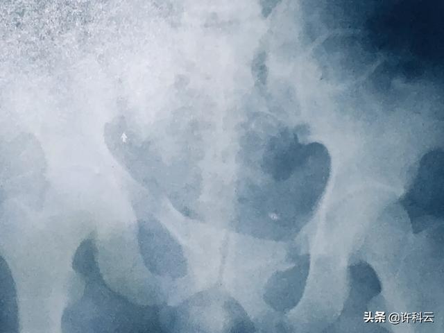 放射科宣传视频
:学医的你，对放射科了解多少？  第6张
