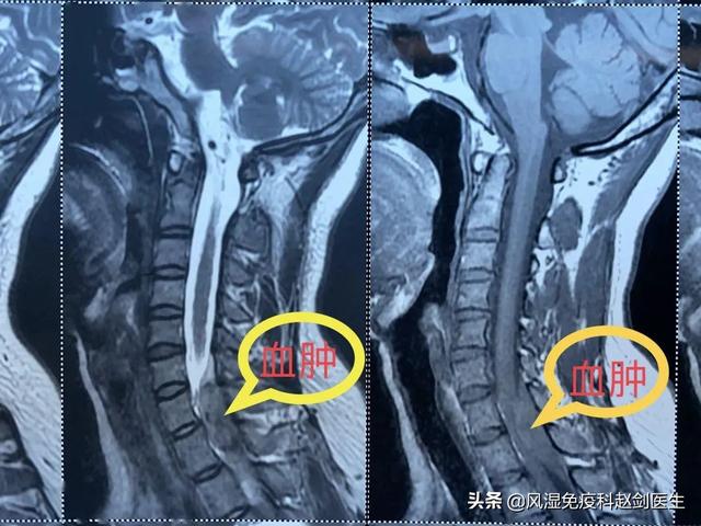 颈椎病有什么好办法治疗的短视频
:颈椎病正确的医治方法有哪些？  第3张