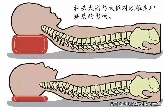 颈椎病有什么好办法治疗的短视频
:颈椎病正确的医治方法有哪些？  第11张